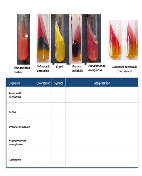 enterobacter aerogenes test results|Klebsiella aerogenes .